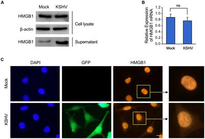 HMGB1, a potential regulator of tumor microenvironment in KSHV-infected endothelial cells